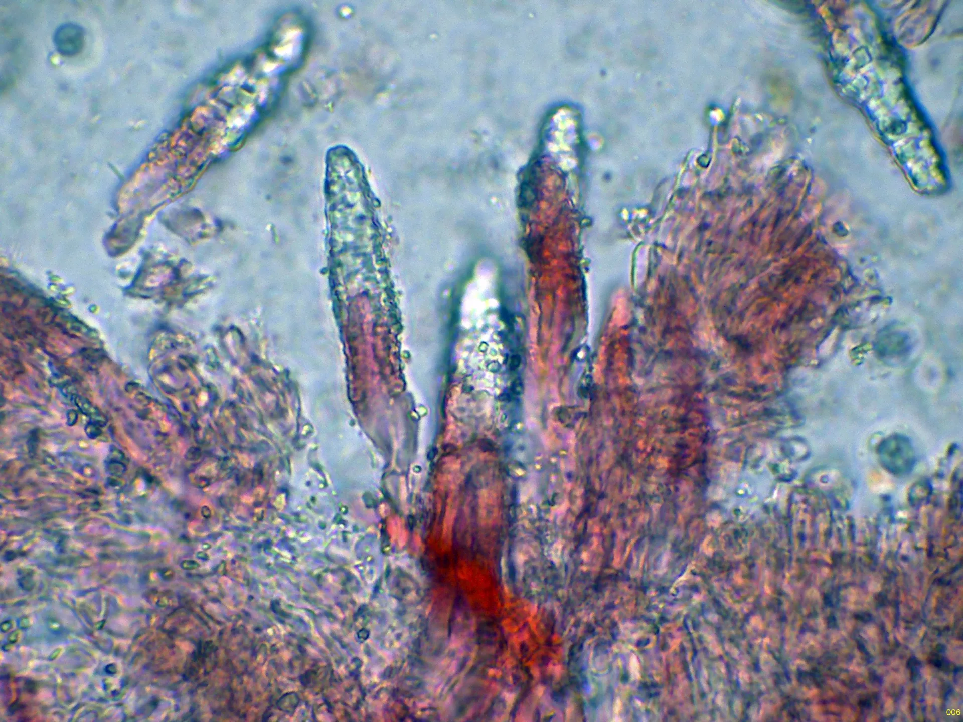 Microscopía de Scopuloides rimosa - 10 - Cistidios-006